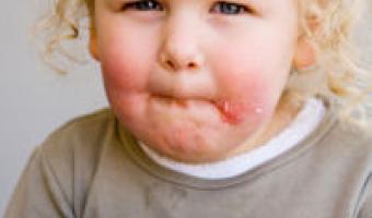 Quarter of children overweight by five, WHO study finds